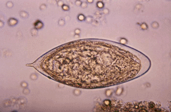 Image: Schistosoma haematobium egg (Photo courtesy of the CDC).